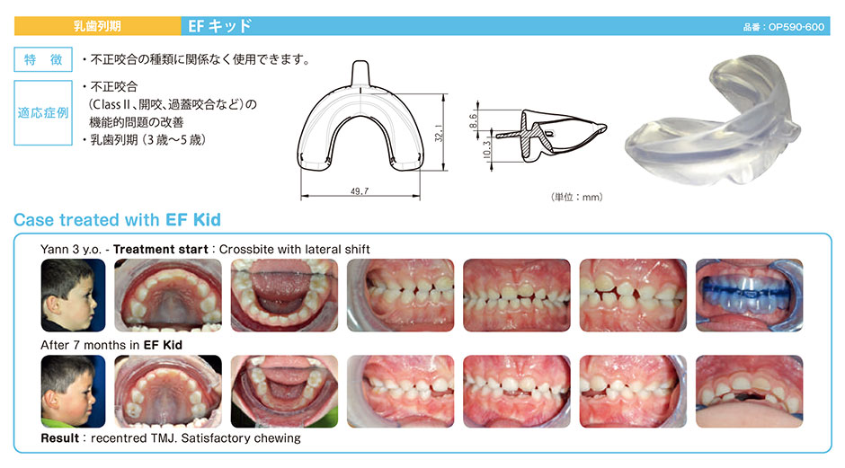 EFLine | 生体親和性の高い矯正器具の開発・販売 オーソデントラム